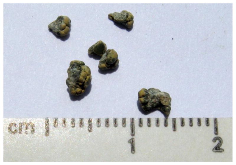 Canine 2,8-DHA stones next to a ruler to show size